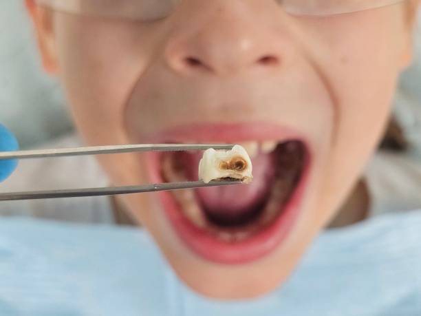 Best Weekend Emergency Dentist in Graham, NC