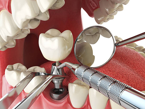 Best Pediatric Emergency Dentist in Graham, NC